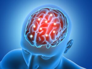 Neurological Treatment